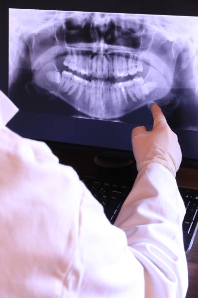 Best Emergency Wisdom Tooth Extraction in Southport, CT